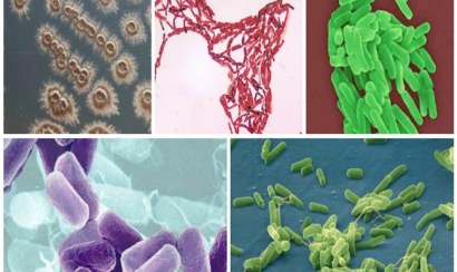 Bùn vi sinh xử lý nước thải chất lượng, uy tín